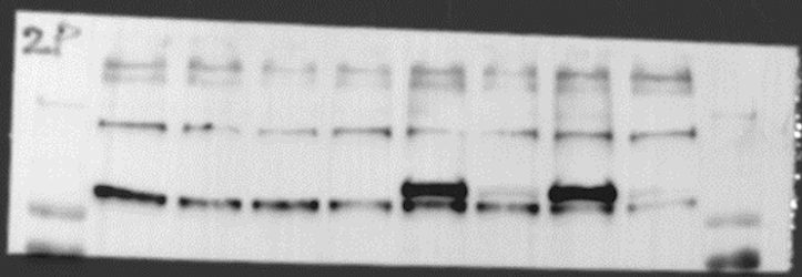 A PVDF membrane with protein bands detected by antibodies and chemiluminescent substrate.