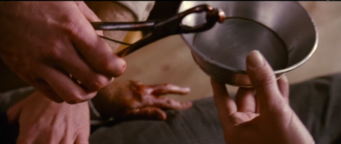 scene from 3:10 to Yuma . Extraction of a bullet