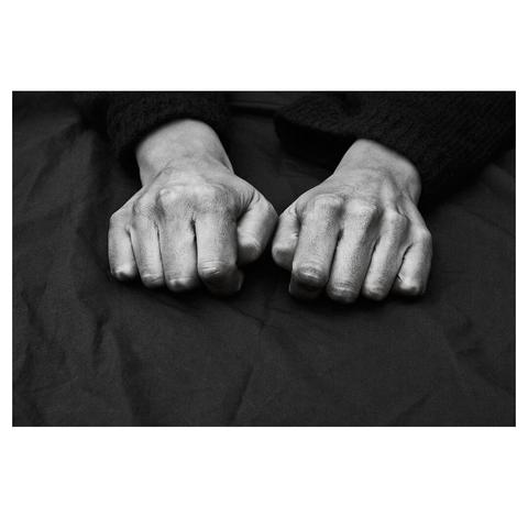 A pair of clenched fists resting on a dark sheet.