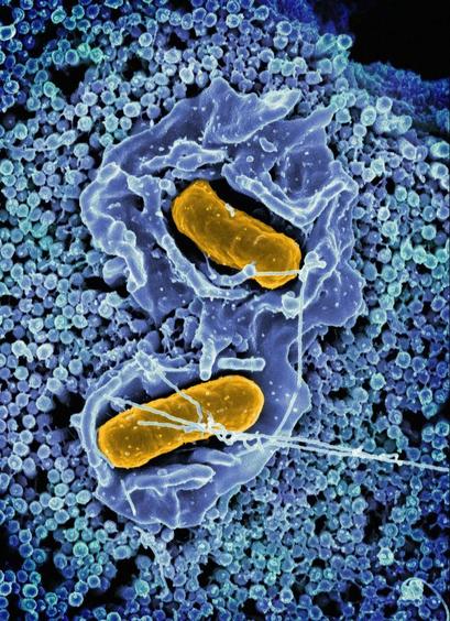 Microscope image of a cell, courtesy of National Institute of Allergy and Infectious Diseases
