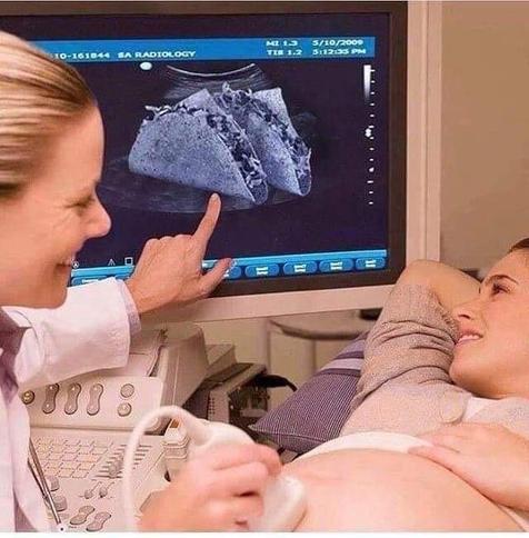 A woman is lying on an exam table getting an ultrasound. The doctor smiles and points to the screen, which shows two tacos.