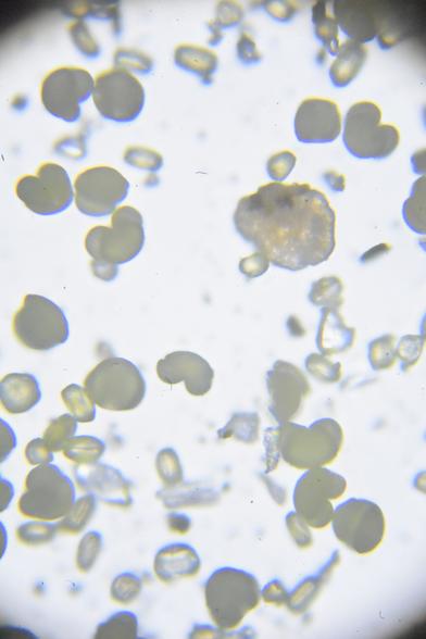 Whitefield microscope image of various pollen grains. Some, seemingly from pines, have a characteristic triple-lobe shape.