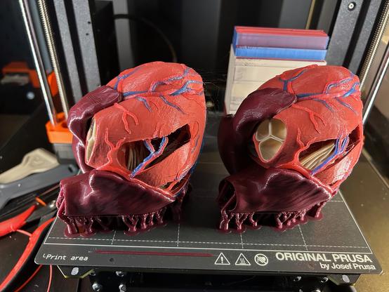 A finished print of two anatomically correct human hearts in five colors.  They are still attached to the print bed.