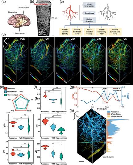 The image is a composite of multiple panels illustrating various aspects of brain structure and function.