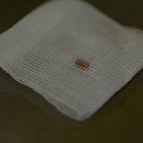 Ein dreckiger Tupfer aus Gaze mit einem Tropfen Blut