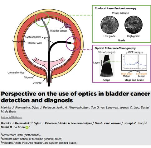 Chart from the Gold Open Access article "Perspective on the use of optics in bladder cancer detection and diagnosis," in Journal of Biomedical Optics 30(4) 040601 (2025), DOI: 10.1117/1.JBO.30.4.040601