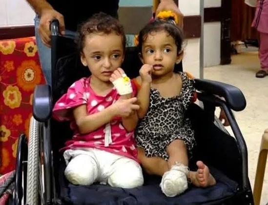 Alt Text (English):
Two young Palestinian girls sit in a wheelchair. Both have lost legs due to Israeli airstrikes. One wears a pink dress with white polka dots, the other a leopard-print outfit. Their faces show shock and confusion — innocent lives forever changed by war.