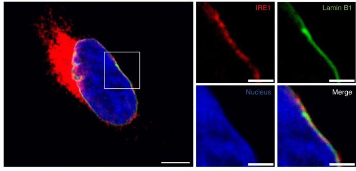 Detection of endogenous Halo-tagged IRE1 and non-tagged Lamin B1 by confocal microscopy. U2OS HaloTag cells, containing a C-terminal HaloTag into the endogenous IRE1 gene locus, were examined. Cells were cultured in the presence of Janelia 646 HaloTag ligand (green), fixed, stained with anti-Lamin-B1 (red) antibodies, and analyzed by confocal microscopy. Left: Merge field of IRE1 (red), Lamin B1 (green), and nucleus (blue) is shown. Scale bar = 5 μm. Right: Close up of the nuclear envelope where each channel is shown separately and merged. Scale bar = 2 μm. Pixel size = 48 nm. Representative image of two independent experiments shown.