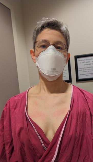 selfie in a hospital changing room, wearing an N95 mask and pink hospital gown, with red bruises on my chest where the mammogram machine squeezed me