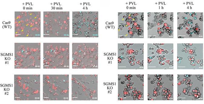 Left: WT and SGMS1 KO THP-1 macrophages were treated with PVL (62.5 ng/ml) and LysoTracker Red (red, acidic organelles) and Draq7 (blue, dead cells) fluorescence imaged over time. Yellow arrows indicate cells that lose LysoTracker Red signals prior to Draq7. Scale bar is 50 μm. Right: WT and SGMS1 KO THP-1 macrophages were treated with PVL (62.5 ng/ml) for the indicated time and MitoTracker TMRM (red) and Draq7 (blue) fluorescence imaged. Yellow arrows indicate the loss of TMRM signals prior to Draq7 uptake. Scale bar is 50 μm.