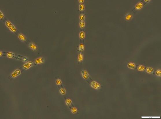 microscopic picture of chains of single-celled algae