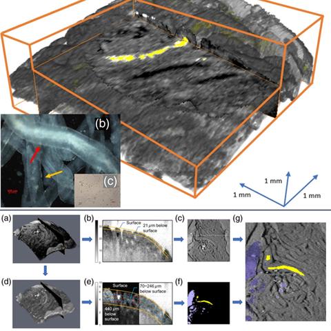 A figure of OCT and a dissecting microscope with transillumination images.