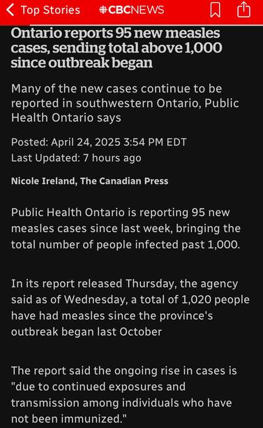 < Top Stories CBCNEWS
Ontario reports 95 new measles cases, sending total above 1,000 since outbreak began
Many of the new cases continue to be reported in southwestern Ontario, Public Health Ontario says
Posted: April 24, 2025 3:54 PM EDT
Last Updated: 7 hours ago
Nicole Ireland, The Canadian Press
Public Health Ontario is reporting 95 new measles cases since last week, bringing the total number of people infected past 1,000.
In its report released Thursday, the agency said as of Wednesday, a total of 1,020 people have had measles since the province's outbreak began last October
The report said the ongoing rise in cases is
"due to continued exposures and transmission among individuals who have not been immunized."