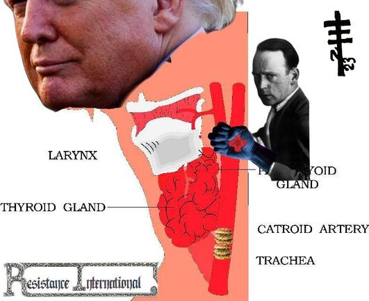 A digital collage using linked clip art cross section view of a human head. You can see half of trump's orange face. Big macs are blocking the carotid artery and john hearfield is using the phreak power fist. A resistance International sigil in upper right and masthead in bottom left