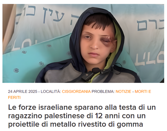 Amir Rami Ibrahim Haddad, 12 anni, è stato colpito alla testa da un soldato israeliano con un proiettile di metallo rivestito di gomma ad aprile. (Foto: per gentile concessione della famiglia Haddad)
