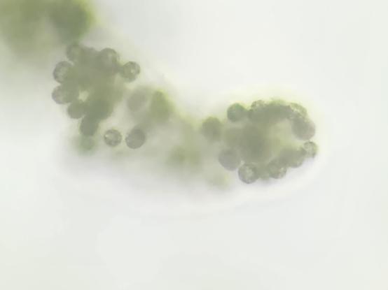 Microscopy image of a clump of greenish cells