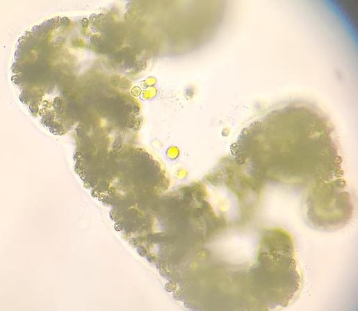 Another clump of cells
