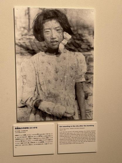 A photograph of Yukiko Fujii, one of the victims of the atomic bombing, by Yukio Kunihira.