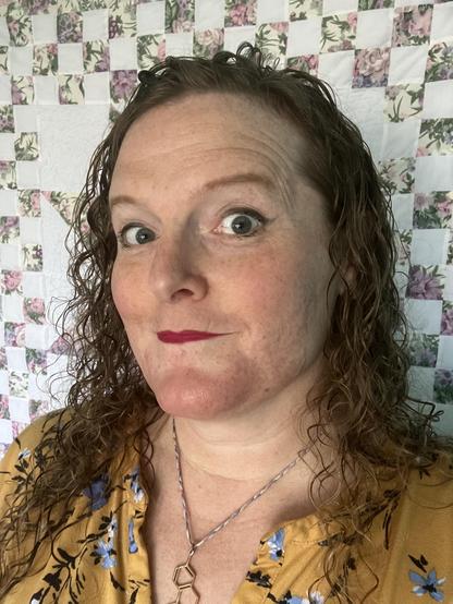 miriam, a white trans woman, sporting mottled swelling across her jawline