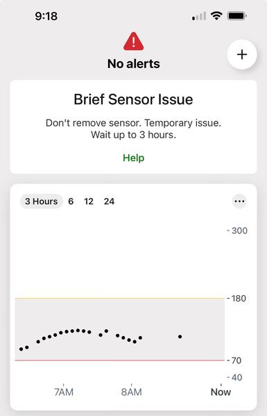 A mobile device screen displays a warning for a "Brief Sensor Issue," advising not to remove the sensor and to wait up to three hours. Below, a graph shows sensor data recorded from 7 AM to the present time, with dots indicating readings.