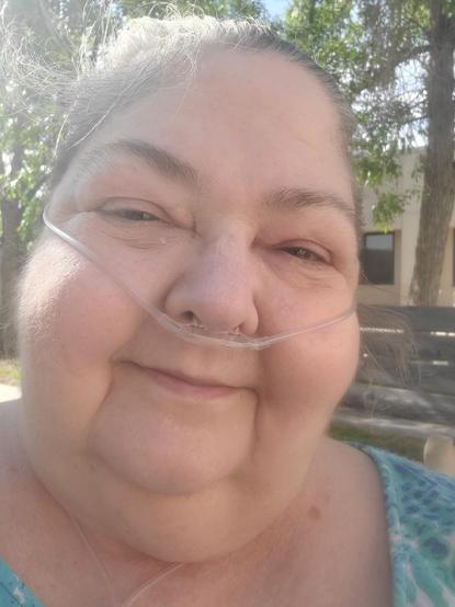 Me again, an anglo woman with hair pulled back, my face all puffy from allergies and steroids, major allergy eyes