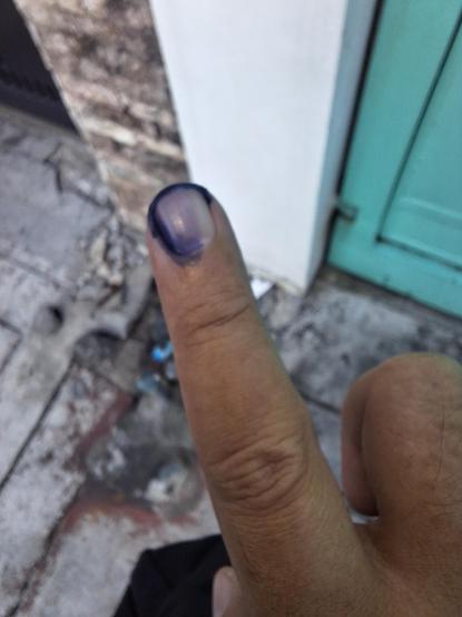 A finger stained with indelible ink, an indicator of having voted