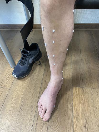 Nackter rechter Unterschenkel, von allen Seiten beklebt mit kleinen ca 4x4 mm großen weißen Schaumstoffwürfeln