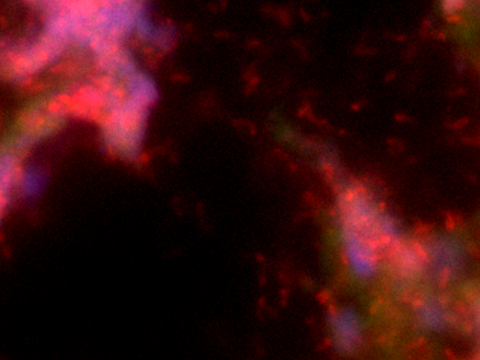Organisms in the biofilm are hard to reach, even for the rRNA fish probe...