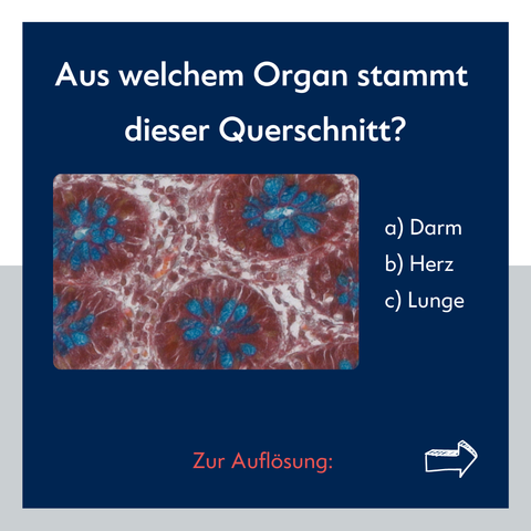 Textfolie, die das vorherige Bild wiederholt. Darüber steht: "Aus welchem Organ stammt dieser Querschnitt? a) Darm, b)  Herz, c) Lunge"