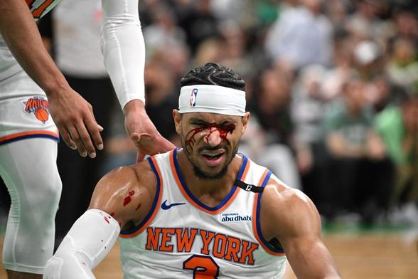 Josh Hart's eye, OG Anunoby struggles & Jalen Brunson's fouls