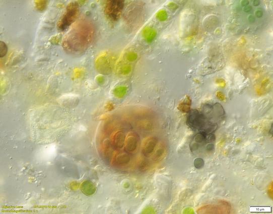 mix of green filamentous algae, cyanobacteria and brown unknowns in gel matrix
