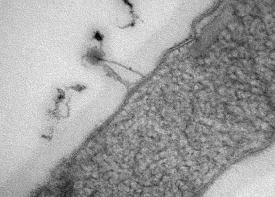 Electron microscope image of a bacteriophage attaching to and infecting the bacterium Pseudomonas aeruginosa. Black and white image. A bacterium runs through the picture as a gray elongated area. A small “pin with a head” can be seen on its surface (the phage).  © Charité | Shailey Gale Twamley