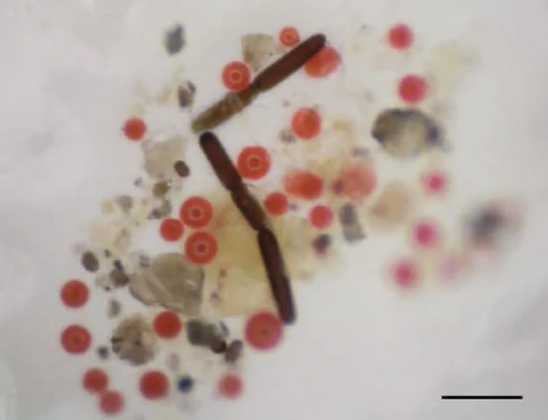 A microscopic image of various single-celled algae. Some are round and bright red, others are elongated and much darker.