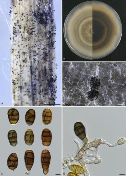 The new toxin-producing species Pseudopithomyces toxicarius with sporulation on grass, photo growing on agar plates, and microscopy images of the spores