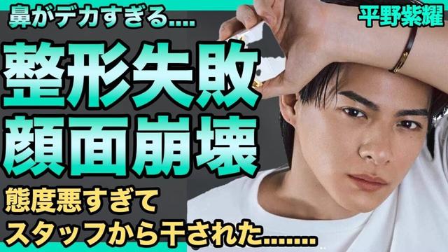 平野紫耀の顔面崩壊した現在...整形失敗し肥大した鼻がヤバすぎる...ビジュ悪くなり人気急落し完全終了...態度悪すぎてスタッフから嫌われ干された真相...彼女の正体に驚きを隠せない！