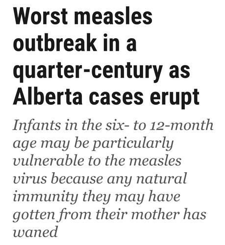 Worst measles
outbreak in a
quarter-century ds
Alberta cases erupt
Infants in the six- to 12-month
age may be particularly
vulnerable to the measles
virus because any natural
immunity they may have
gotten from their mother has
waned