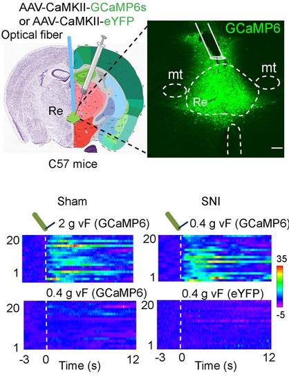 RE neurons respond to pain-like stimuli, emotional changes, and social interaction in SNI mice. Top: Diagram of virus injection (left) and an example image (right) of GCaMP6s expression in the RE. Bottom: Heat maps of changes in GCaMP6s and eYFP signals in the RE in response to von Frey filament (vF) stimulation on the injured hind paw in SNI or sham mice.