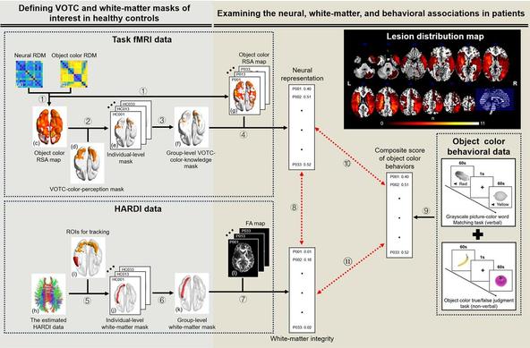 Flowchart of the imaging and behavioral data analysis and the lesion distribution map of the 33 patients. The data processing workflow was as follows. Top left: Workflow for task fMRI data. Bottom left: workflow for HARDI data. Bottom right: Workflow for correlation analysis. Top right: the lesion distribution map of the 33 patients.