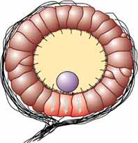 Drawing of the statocyst system from Wikipedia. The cells with the sensory hairs can be seen around the inner area and a statolith is drawn in purple.