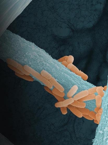 The growth of 𝘓𝘪𝘨𝘪𝘭𝘢𝘤𝘵𝘰𝘣𝘢𝘤𝘪𝘭𝘭𝘶𝘴 𝘮𝘶𝘳𝘪𝘯𝘶𝘴 (orange), a member of the murine lung microbiome, along the hyphae of the lung-pathogenic fungus 𝘈𝘴𝘱𝘦𝘳𝘨𝘪𝘭𝘭𝘶𝘴 𝘧𝘶𝘮𝘪𝘨𝘢𝘵𝘶𝘴 (blue), with lung tissue in the background.
