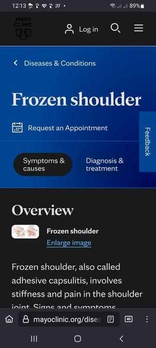 The image is a screenshot of a mobile device displaying a webpage from the Mayo Clinic website. The top section of the screen shows the Mayo Clinic logo, a "Log in" button, and a search icon, along with the time (12:13), battery level (89%), and weather information (29°). The main content area is blue and features the title "Frozen shoulder" in large white text. Below the title, there is a "Request an Appointment" button with a calendar icon. Two buttons labeled "Symptoms & causes" and "Diagnosis & treatment" are visible. The "Overview" section is black with white text, describing frozen shoulder as "adhesive capsulitis," which involves stiffness and pain in the shoulder joint. An "Enlarge image" link is present, and there is a small image of a shoulder joint. The bottom of the screen shows a navigation bar with a home icon, a search bar with the URL "mayoclinic.org/disea," and a back button.

 Ovis2-8B

🌱 Energy used: 0.242 Wh