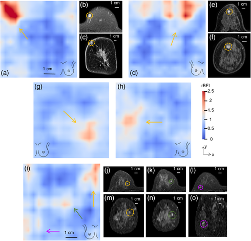 A chart of representative DCT and MRI images that contain lesions.