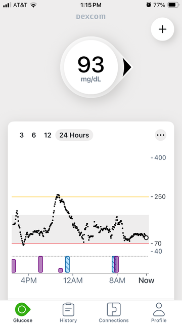 Screenshot of a continuous glucose monitor showing a normal current reading of 93 mg/dL, and a graph with wild swings outside the normal range over the past 24 hours.