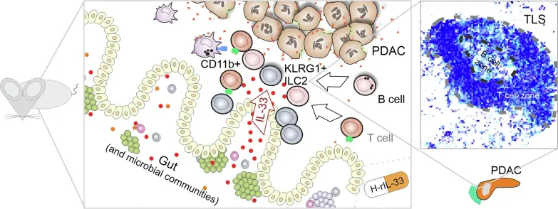 Figure from https://rdcu.be/enDx6 giving an overview of the tertiary lymphoid structures and suggested initiation factors
