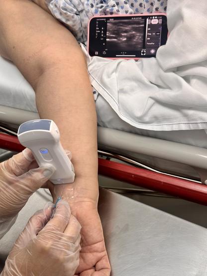 A medical professional is using an ultrasound device to assist with a procedure on a patient's arm, which shows a clear view of the skin and an intravenous needle being inserted. A smartphone displaying ultrasound imagery is placed nearby.