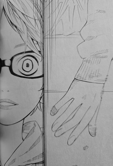 Photograph of two side by side black and white panels from Your Lie in April. The right panel shows a human hand hanging from a gurney with bandages on a few fingers, something is dropping from it. The left has a zoom in on a teenage boy's face, washed out and in shock with wide eyes. The boy is wearing glasses and only half of his face is visible.