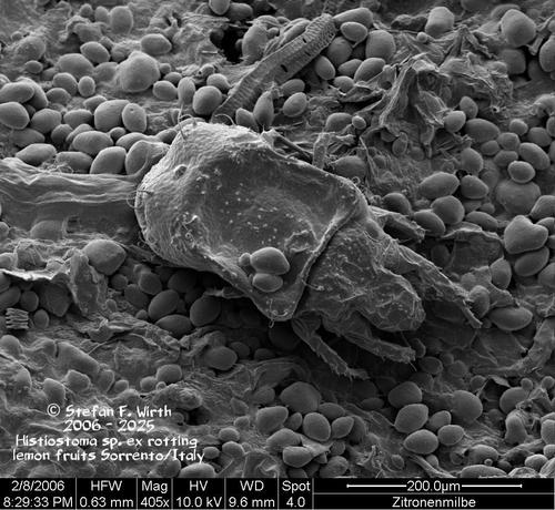 Female of mite Histiostoma sp. (Histiostoma feroniarum complex, Histiostomatidae, Astigmata) from rotting lemon fruits in Sorrento/Italy, SEM 2006, this version 2025, © Stefan F. Wirth, Berlin