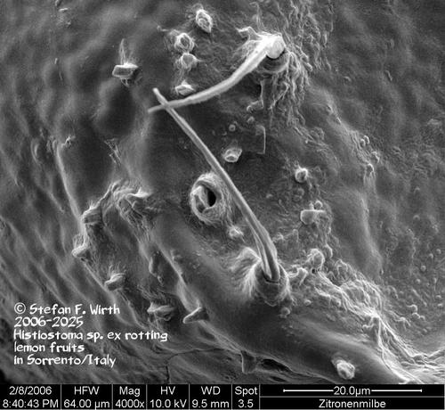 Female of mite Histiostoma sp. (Histiostoma feroniarum complex, Histiostomatidae, Astigmata) from rotting lemon fruits in Sorrento/Italy, SEM 2006, this version 2025, © Stefan F. Wirth, Berlin