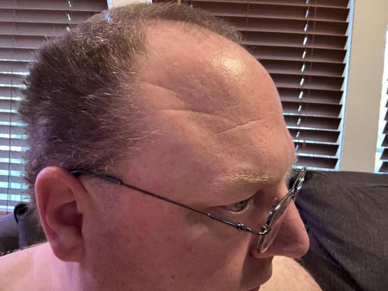 A white guy in glasses looks to the viewer’s right, the camera angles to show off what’s left of his hair.