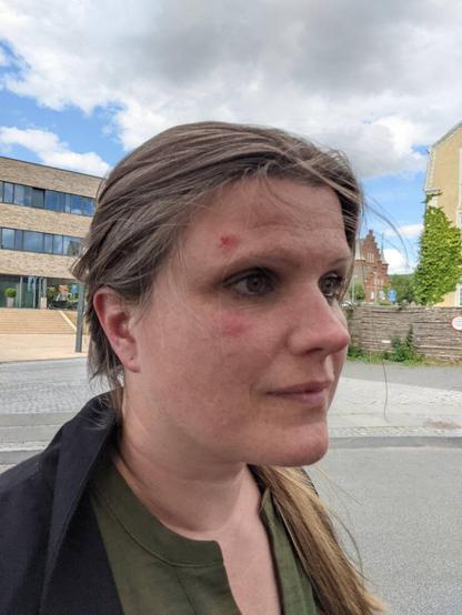 Assoc. Prof. Laura Horn, injured after the action at Roskilde Airport in June 2023.